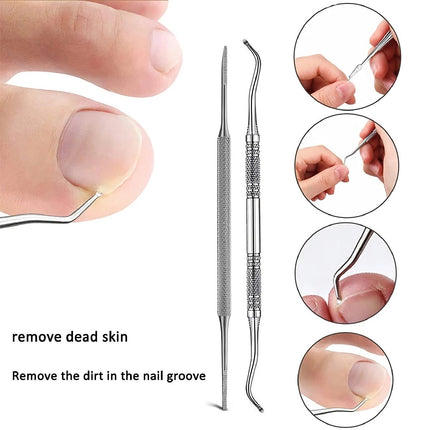 Kit de traitement professionnel pour ongles incarnés avec patchs de correction et outils de pédicure