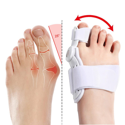 ComfortAlign 2Pcs Hallux Valgus and Bunion Corrector – Orthopedic Toe Separator and Foot Care Solution - Wnkrs