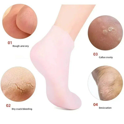 Silicone Spa Moisturizing Gel Socks for Foot Exfoliation & Care - Wnkrs