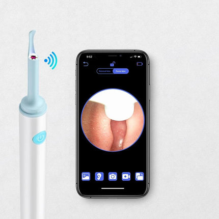 Wireless 3.9mm HD Ear Camera: Luminous Ear Cleaner & Otoscope - Wnkrs