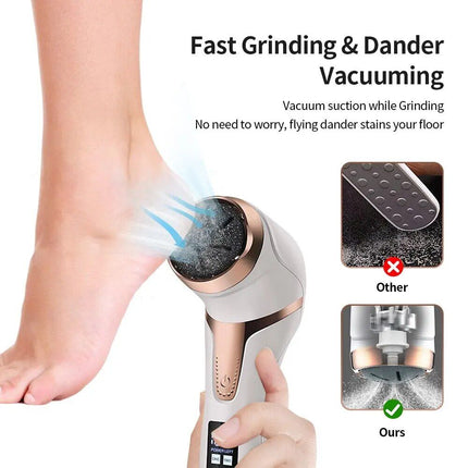 Rechargeable Electric Foot Callus Remover: Portable Pedicure Tool for Smooth Feet - Wnkrs