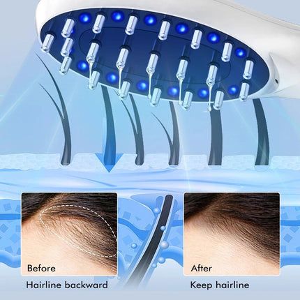 Electric Hair Growth and Scalp Health Massage Comb with Red/Blue Light Therapy - Wnkrs