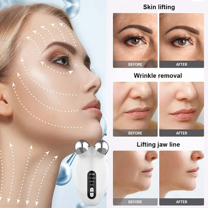 Rodillo de microcorriente facial EMS: lifting facial y eliminación de papada