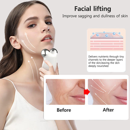 Rodillo de microcorriente facial EMS: lifting facial y eliminación de papada