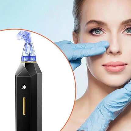 Electric Pore Vacuum with Dark Spot Removal & Oxygen Injection - Wnkrs