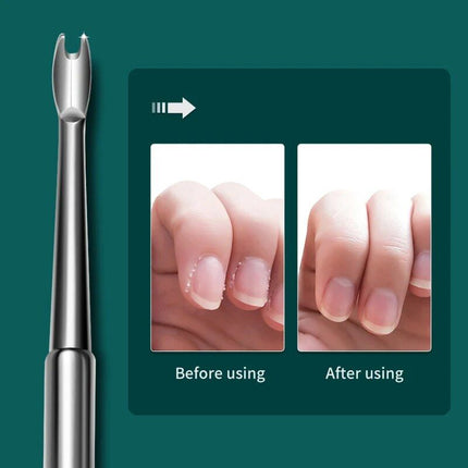 Cuticle Remover & Dead Skin Pusher - Surgical Grade Stainless Steel - Wnkrs