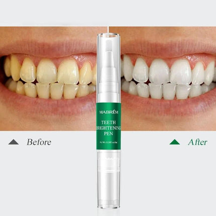 Instant Teeth Whitening Pen - Wnkrs