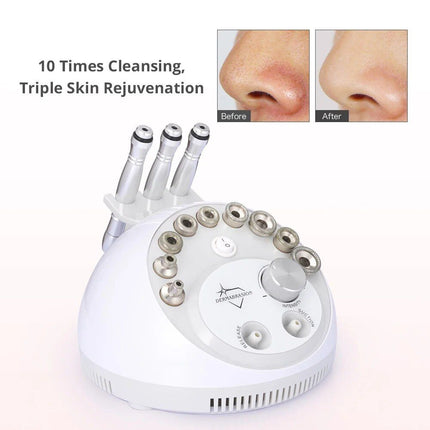 3-in-1 Diamond Microdermabrasion Beauty Machine - Wnkrs