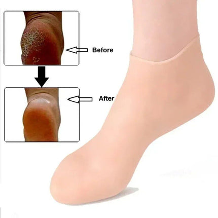 Silicone Spa Moisturizing Gel Socks for Foot Exfoliation & Care - Wnkrs