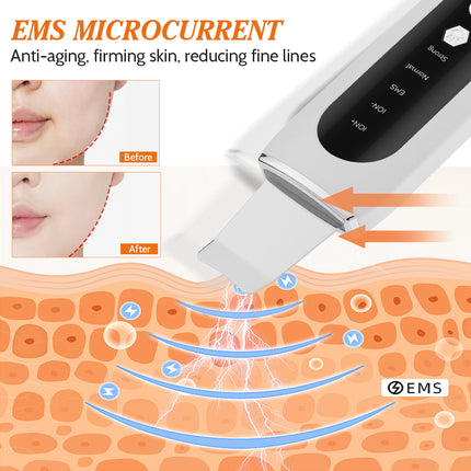 Máquina de peeling facial ultrasónico